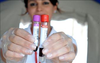 تحليل الدم يفيد في الكشف عن احتمال عودة سرطان الثدي