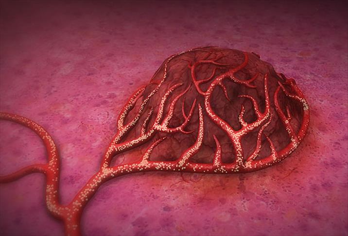 Kanser hastaları şiddetli ağrılardan kurtulacak