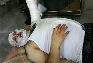 Esed güçlerinin füze saldırısında AA muhabiri yaralandı