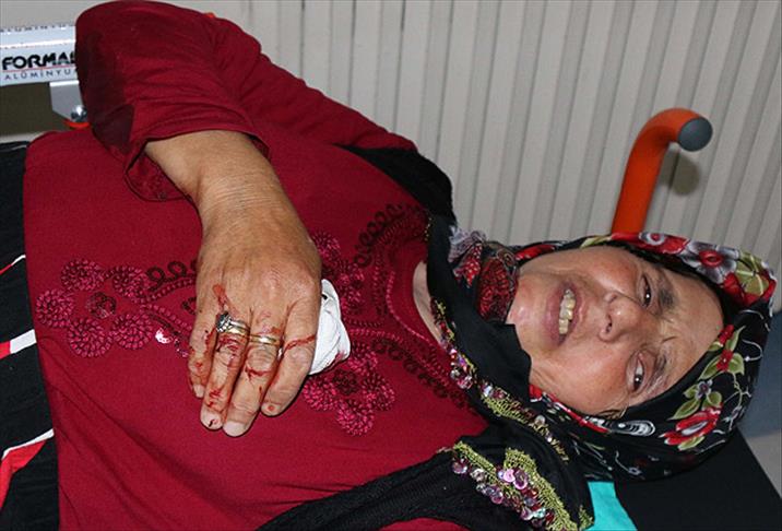 Otlattığı keçi parmağını koparttı