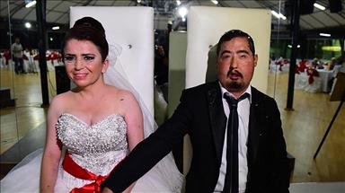 Türkiye'de 4. yüz nakli yapılan Çolak dünyaevine girdi