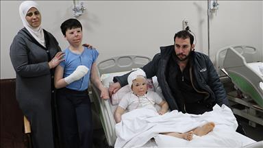 Suriyeli kardeşlerin yüzlerindeki savaş izleri Türkiye'de silinecek