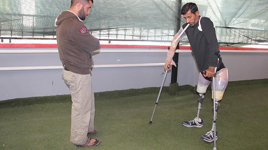 Üç protezle hayata tutunmaya çalışıyor