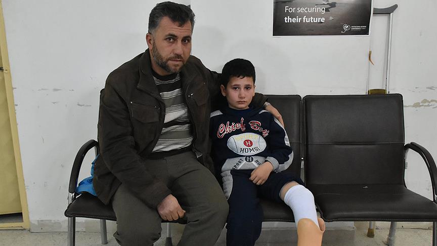 Savaşın yarım bıraktığı çocuğun protez mutluluğu