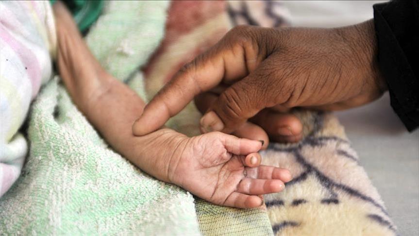 Над детьми в Йемене нависла угроза голодной смерти 