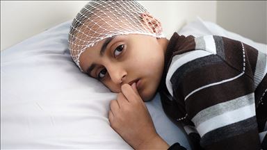 الطفل أسامة.. ضحية قنابل الفوسفور الإسرائيلية يبحث عن علاج في تركيا