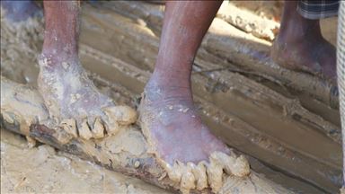 'Dünyada 40 milyon insan köleleştirildi'