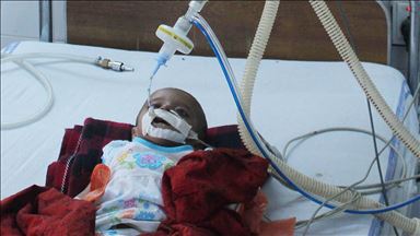 Samoa'da kızamık salgınında ölü sayısı 72'ye yükseldi 