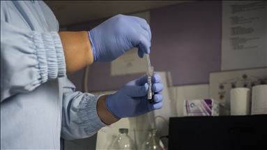 En África cerca de uno de cada 25 adultos está infectado con el VIH/Sida