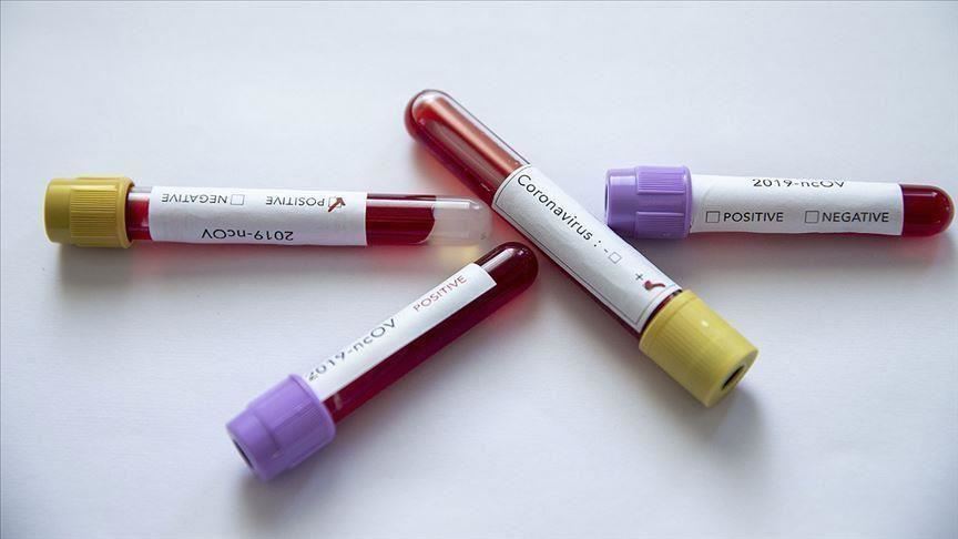 Pakistan confirms fifth coronavirus case