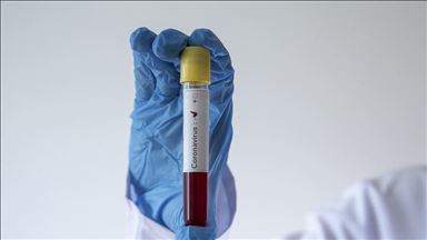 Турција: Во последните 24 часа од Ковид-19 починаа 76 лица