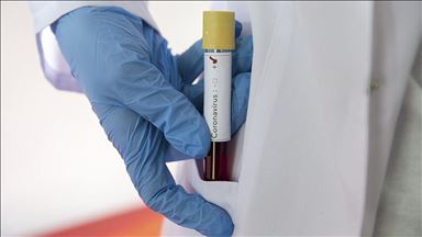 فوت 2 راننده اتوبوس بر اثر ابتلا به کرونا در تهران