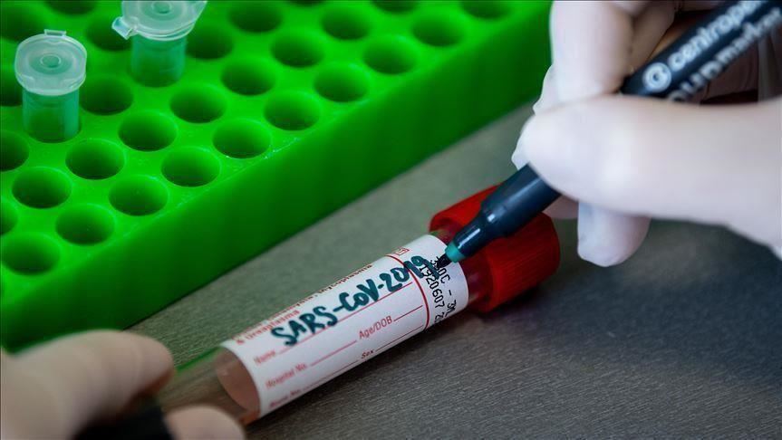 Северна Македонија: Од Ковид-19 починаа 5 лица, регистрирани 120 новозаразени