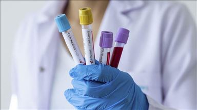 В Узбекистане обновлен рекорд по в COVID-19