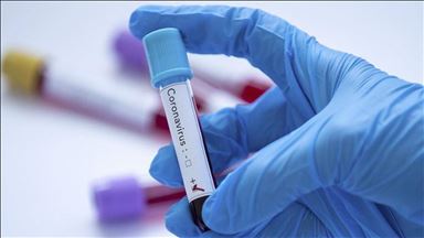 Во Црна Гора два смртни случаи од коронавирусот