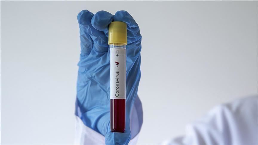 Косово: Починаа 12 лица, откриени уште 190 случаи на Ковид-19