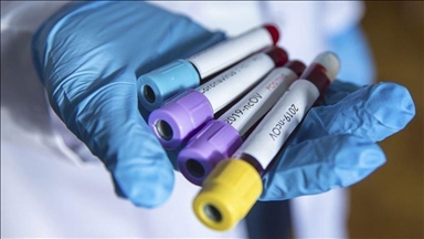 Србија: Со коронавирусот заразени уште 103 лица, два нови смртни случаи