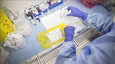 Joint China-US team develops new drug for aggressive brain cancer