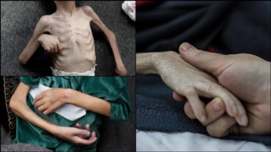 تشدید محاصره غزه توسط اسرائیل؛ کودکان با مرگ دست و پنجه نرم می‌کنند