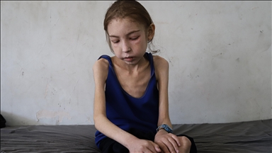 Gazzeli kız çocuğu, İsrail ablukası sebebiyle teşhis ve tedaviden mahrum kaldı