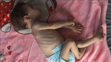 UNICEF: Hiljade beba u Gazi bez odgovarajuće ishrane