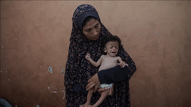 Gazze'de yetersiz beslenme sorunu yaşayan 5 aylık bebeğin annesi çocuğunun ölmesinden korkuyor