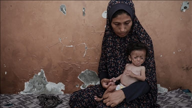 ترس مادر غزه‌ای از مرگ نوزاد پنج ماهه‌اش بر اثر سوء‌تغذیه