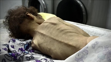 طی یک روز 4 نفر در غزه بر اثر گرسنگی جان باختند