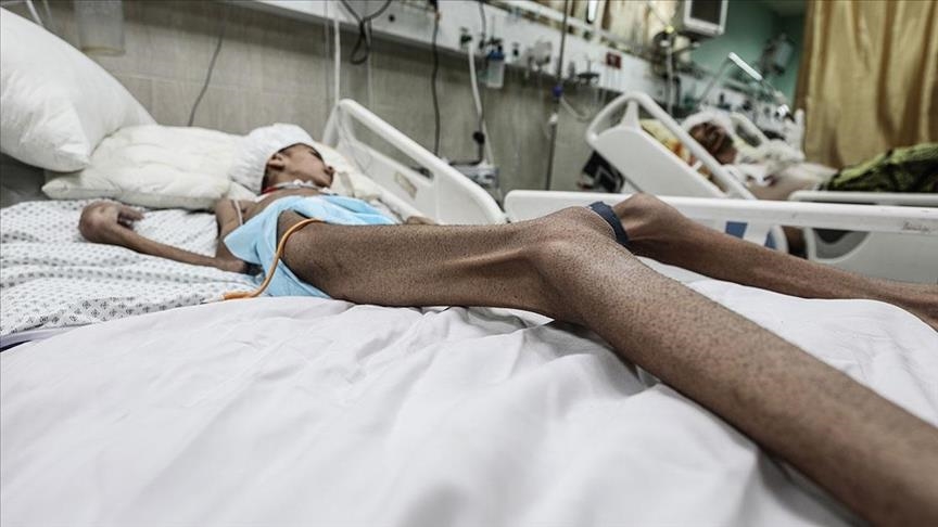 Еще 6 палестинцев умерли  от голода в Газе за последние сутки