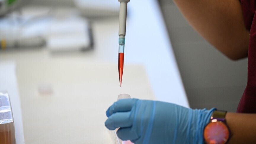 Numri i të vdekurve nga fruthi në Bangladesh rritet në 240  përfshirë 7 fëmijë