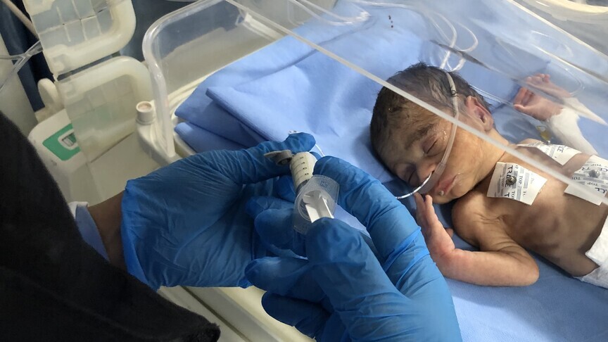 Bllokada izraelite kërcënon mbylljen e të vetmit impiant oksigjeni në Gazën veriore