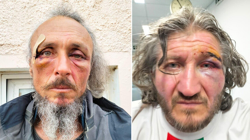 İsrail'in uluslararası sularda Küresel Sumud Filosu'na saldırısında 31 aktivist yaralandı