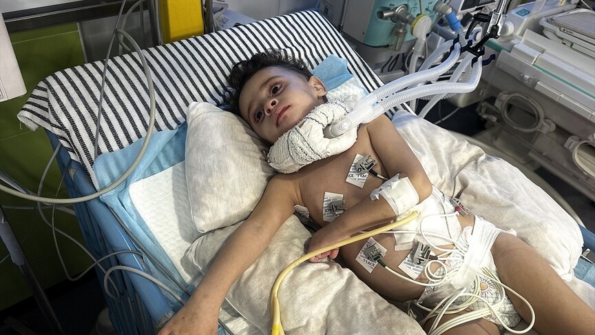 İsrail'in saldırısında yaralanan bebek, Gazze'den çıkışların kısıtlı olması nedeniyle yaşam mücadelesi veriyor