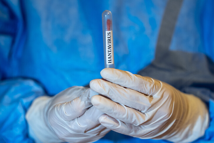 Franca konfirmon rastin e parë me hantavirus