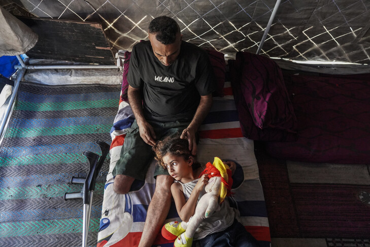 OBSH  43 000 njerëz në Gaza kanë pësuar lëndime që ua kanë ndryshuar jetën që nga tetori i vitit 2023