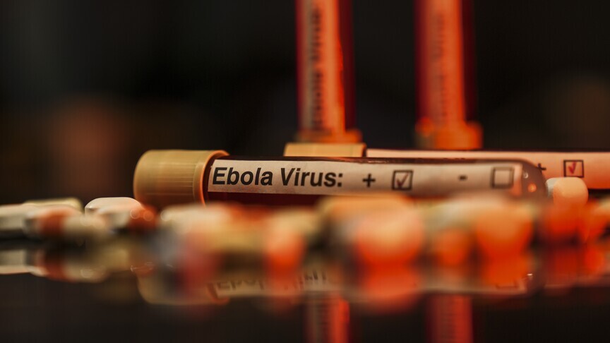 DSÖ, Uganda'da şimdiye kadar 19 Ebola virüsü vakasının görül