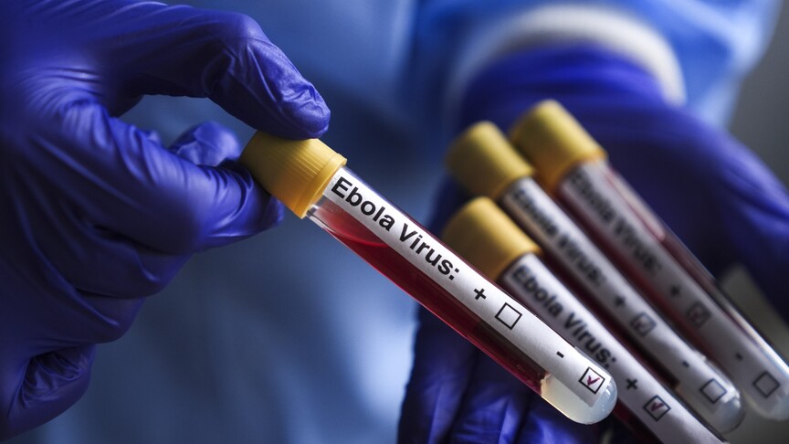ABD, Ebola salgını nedeniyle Kongo Demokratik Cumhuriyeti'ndeki vatandaşlarının ülkeye dönüşünü kısıtladı haber görseli