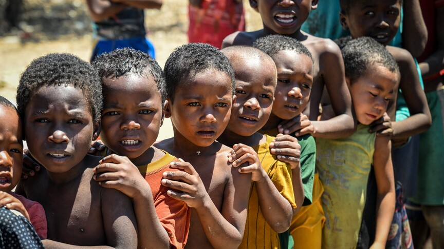 Half a million under-5 children in Madagascar face acute malnutrition, report says