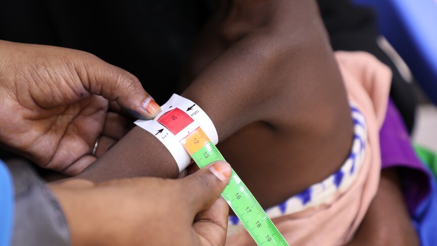 UNICEF, insani yardımların kesildiği Somali'de en büyük bedeli çocukların ödediğini bildirdi haber görseli