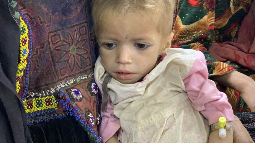UNICEF, Afganistan'da 3,7 milyon çocuğun yetersiz beslenme nedeniyle acı çektiğini bildirdi haber görseli