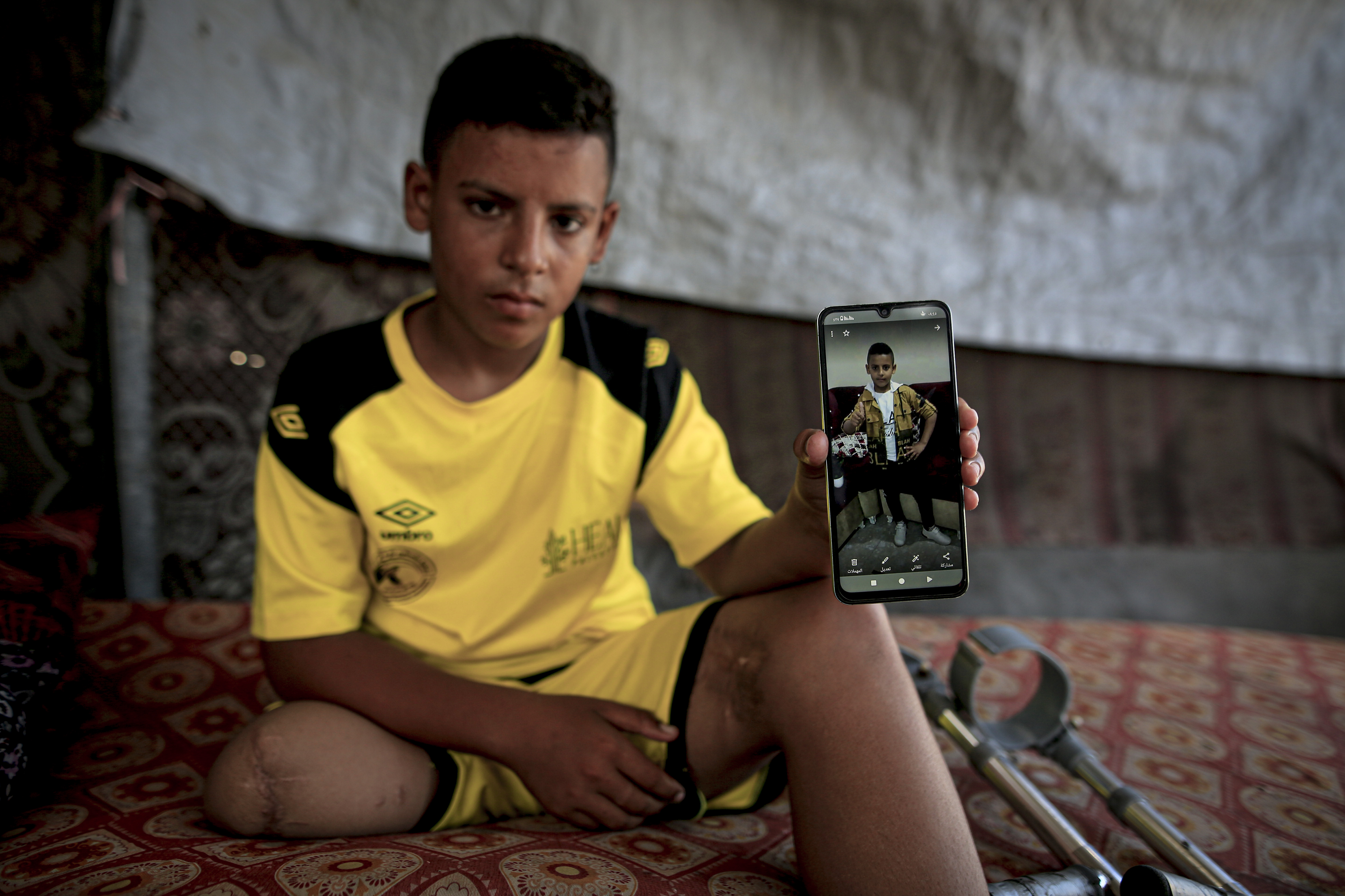 Gazze'de uzuvlarını kaybedenlerden Adidas'a tepki 1 Gazze'de uzuvlarını kaybedenlerden Adidas'a tepki