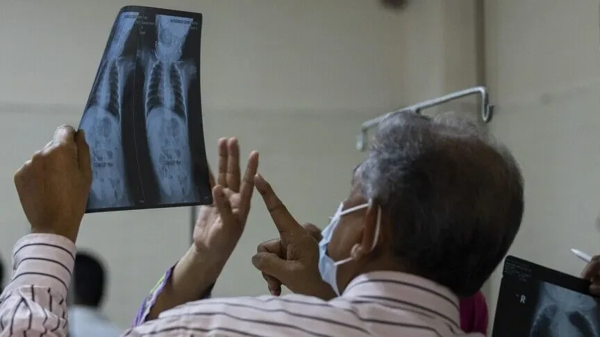 Vdekjet nga fruthi në Bangladesh arrijnë në 1 030 pas vdekjes së tetë fëmijëve të tjerë