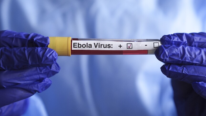 DSÖ, KDC'de Ebola salgınının büyümeye ve can almaya devam ettiğini bildirdi haber görseli