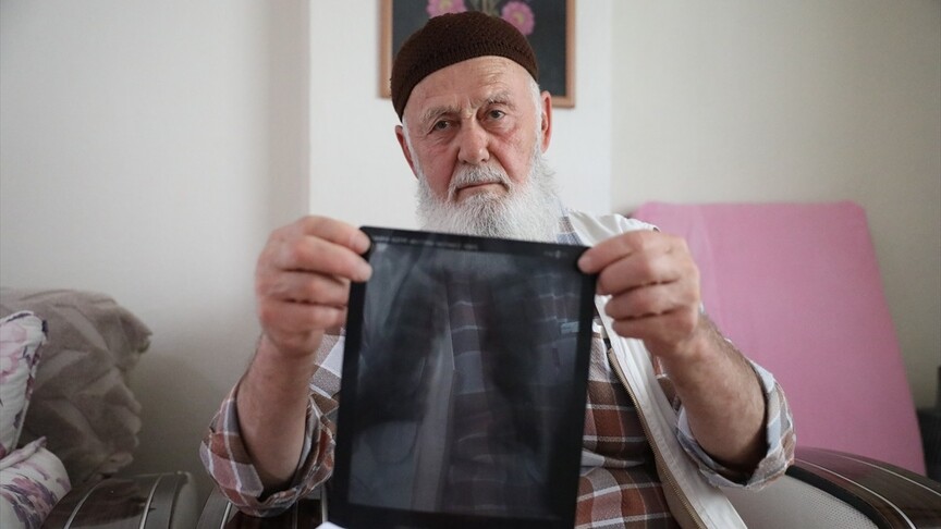 Sigara nedeniyle 3 parmağını kaybeden Osman dede pişmanlığını anlattı