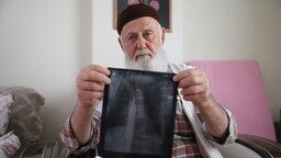 Sigara nedeniyle 3 parmağını kaybeden Osman dede pişmanlığını anlattı