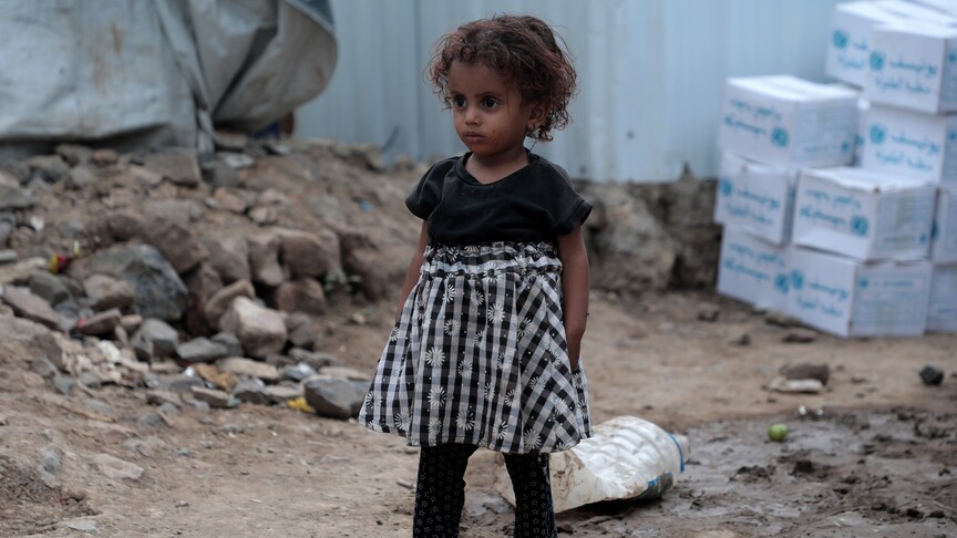 UNICEF: Yemen'de 5 yaş altı 2,2 milyon çocuk akut yetersiz beslenme sorunu yaşıyor