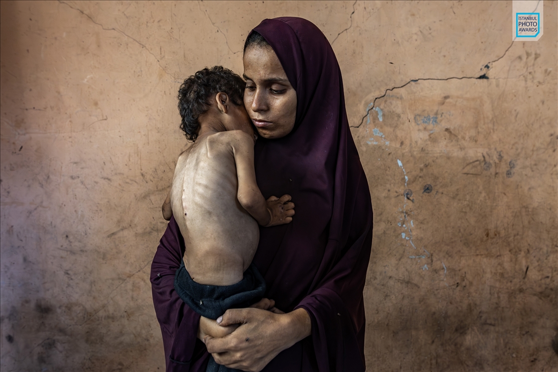 Winners of Istanbul Photo Awards 2026 announced - Single Portrait