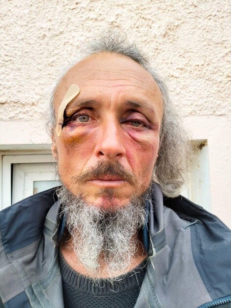 İsrail'in uluslararası sularda Küresel Sumud Filosu'na saldırısında 31 aktivist yaralandı